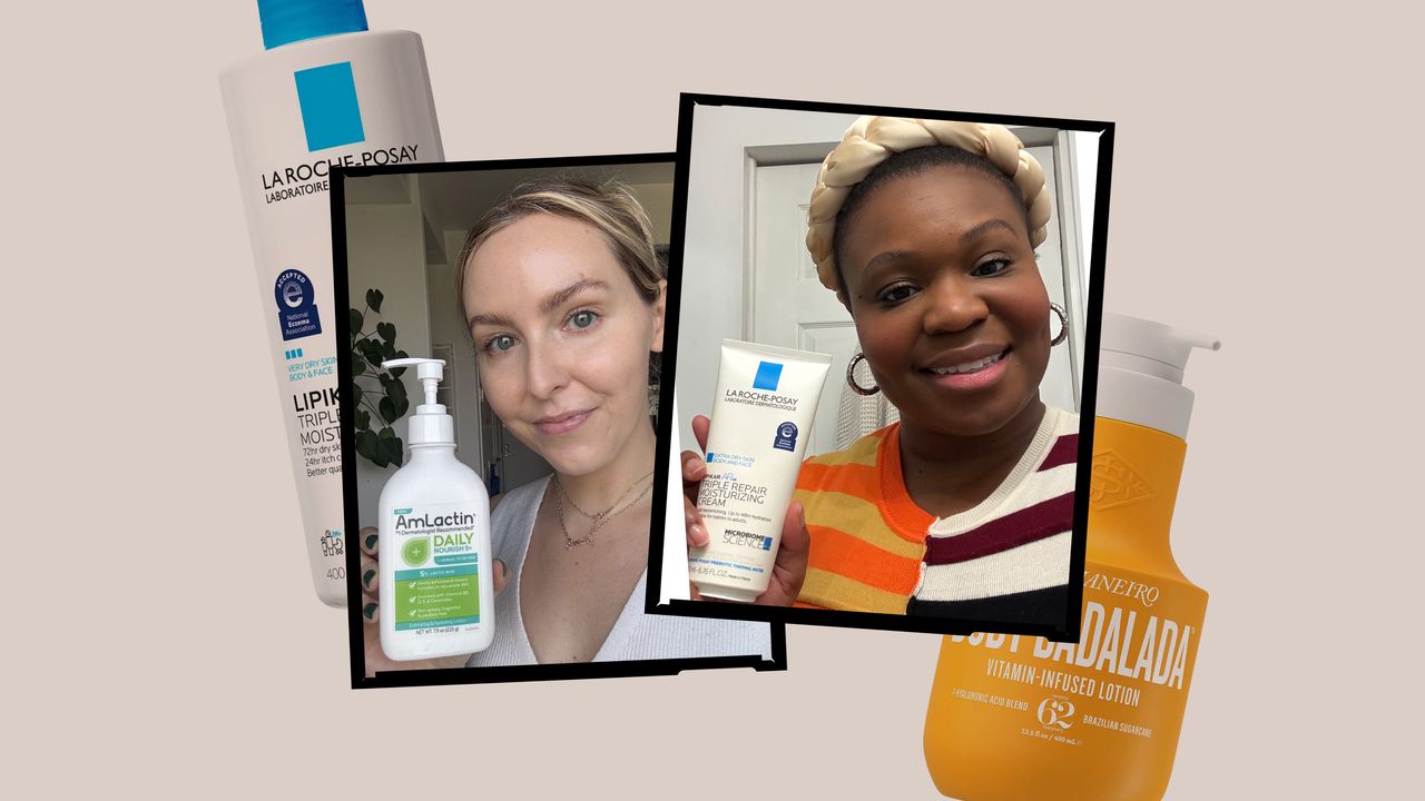 6 Best Lotions for Rough and Bumpy Skin for KP, Strawberry Skin, and More
